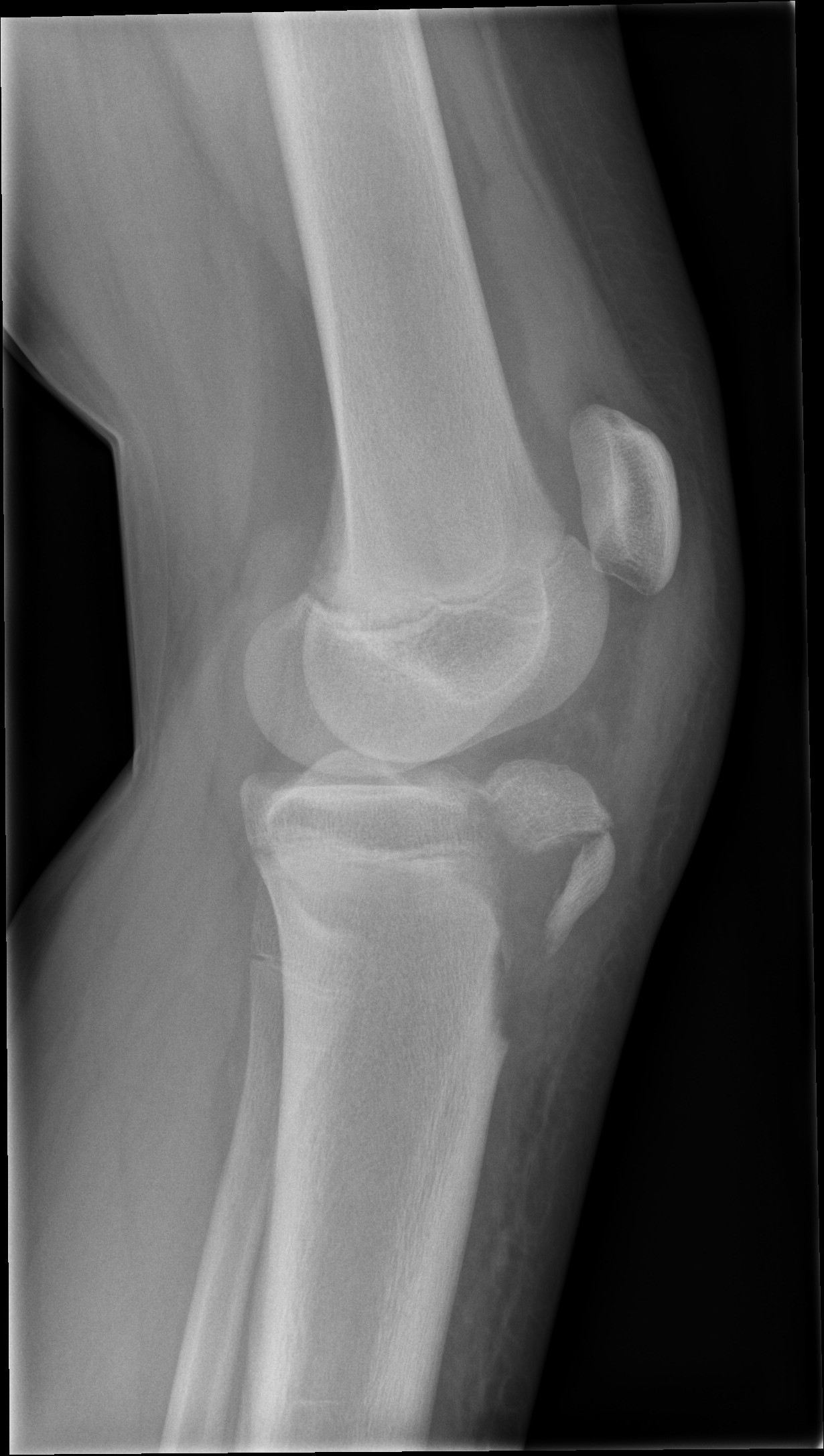 knee lateral